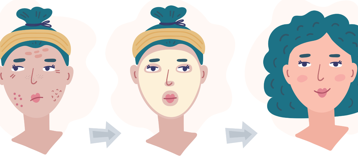 What is Chemical Exfoliation? 14 Essential Insights. The Beauty Maestra