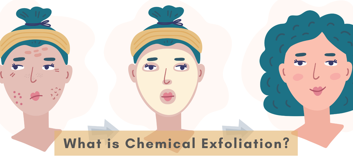 What is Chemical Exfoliation